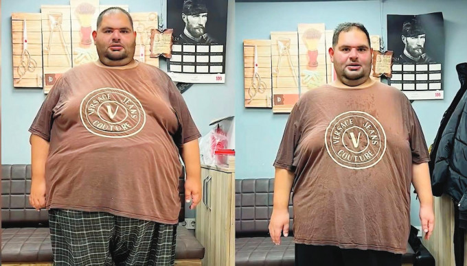 TÜRKİYE'DE İLK MORBİD OBEZİTEYLE MÜCADELE TÜRKİYE'DE İLK MORBİD OBEZİTEYLE MÜCADELE